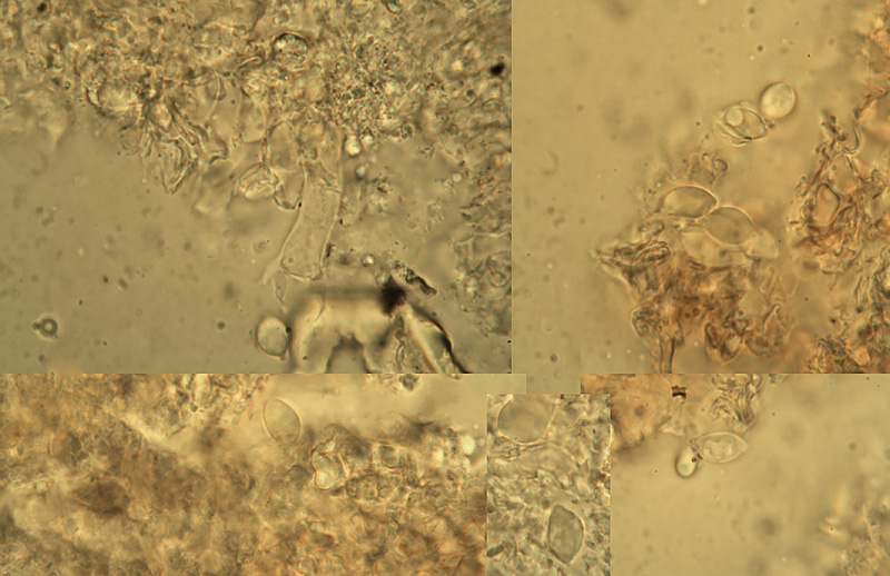 Dendrothele amygdalispora